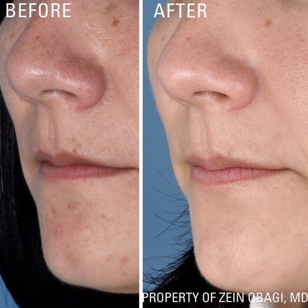 ZO SKIN HEALTH Instant Pore Refiner – Conseils d'utilisation pour pores propres et peau fraîche