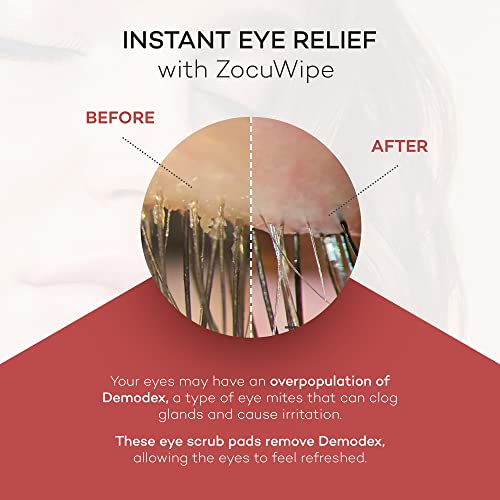 Usage quotidien Zocular ZocuWipe: format pratique et rapide.