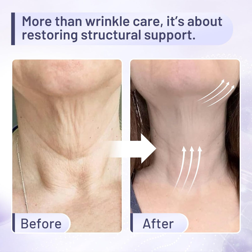 ZZILME Crème Cou – application facile pour hydrater durablement le cou.